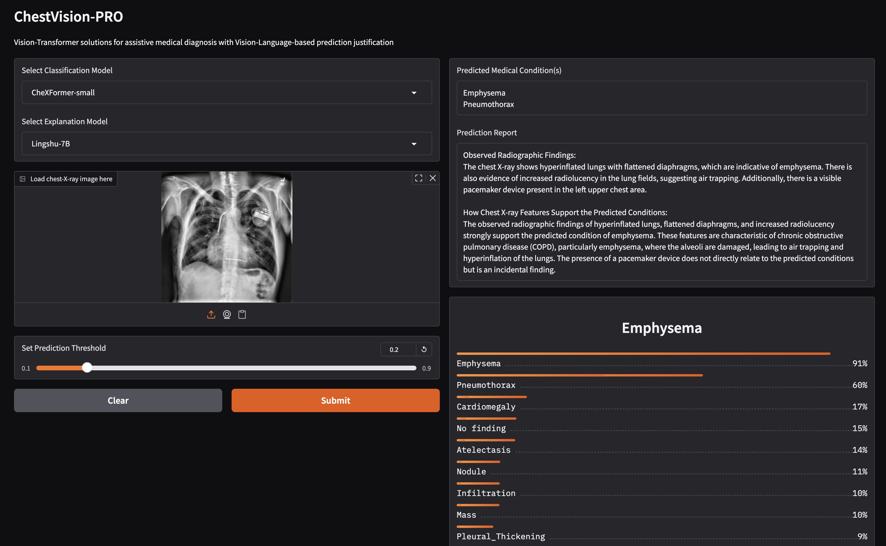 ChestVision-PRO interface