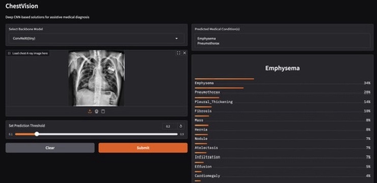 ChestVision interface