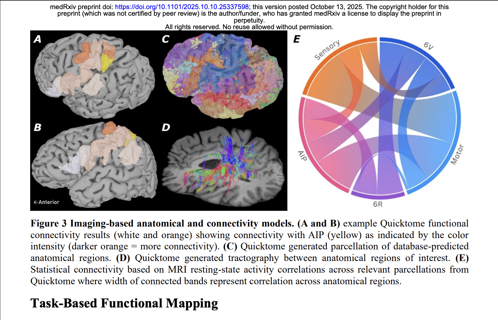 Targeting Optimal Grasp-Related Cortical Areas figure
